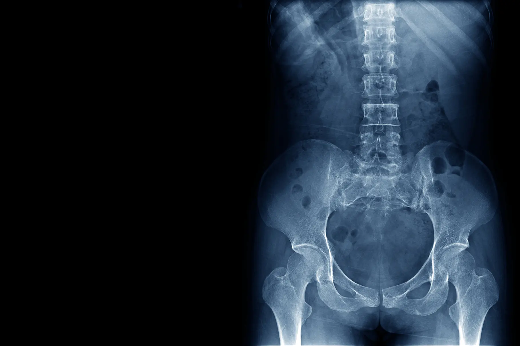 services xray
